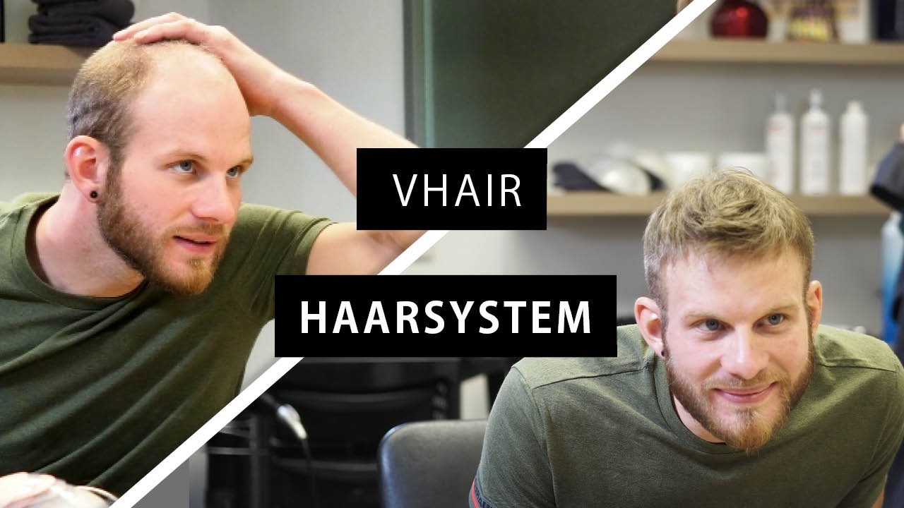 Die Geheimnisse schöner Haare: Entdecken Sie die Vorteile eines Haarsystems